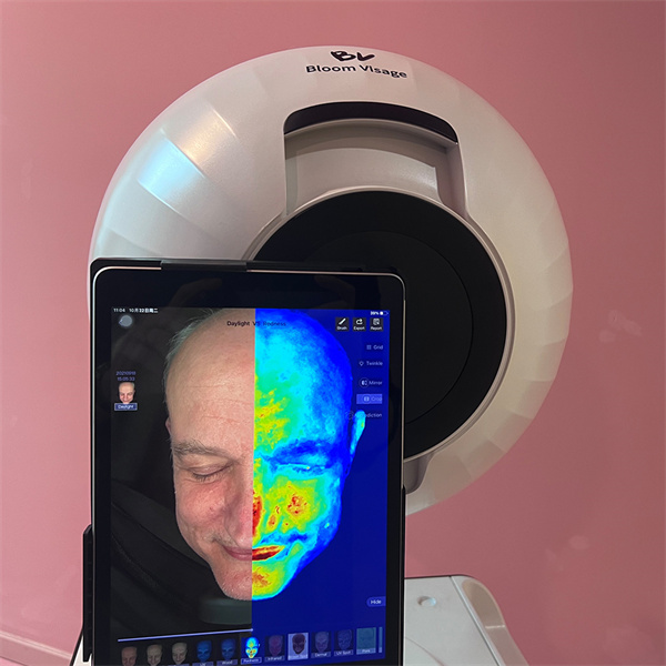 Discover Your Skin's Secrets with the Skin Diagnosis Device