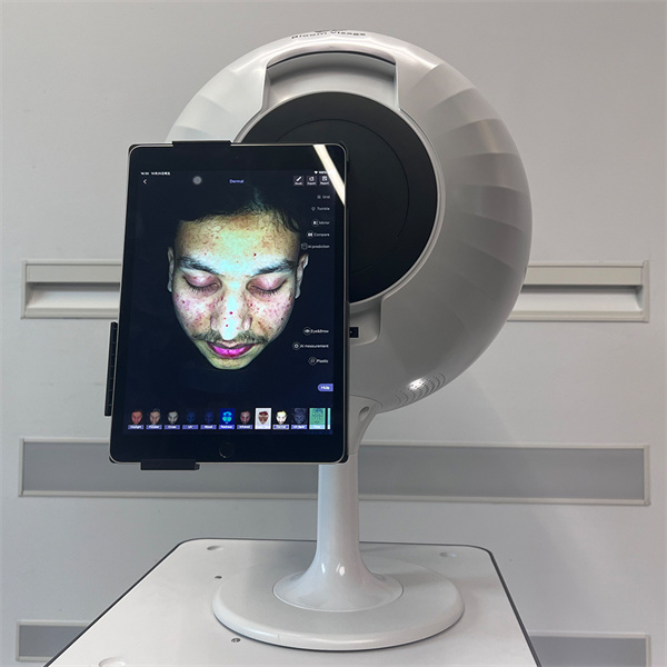 Get Your Perfect Skin with the Latest Skin Analysis Machines