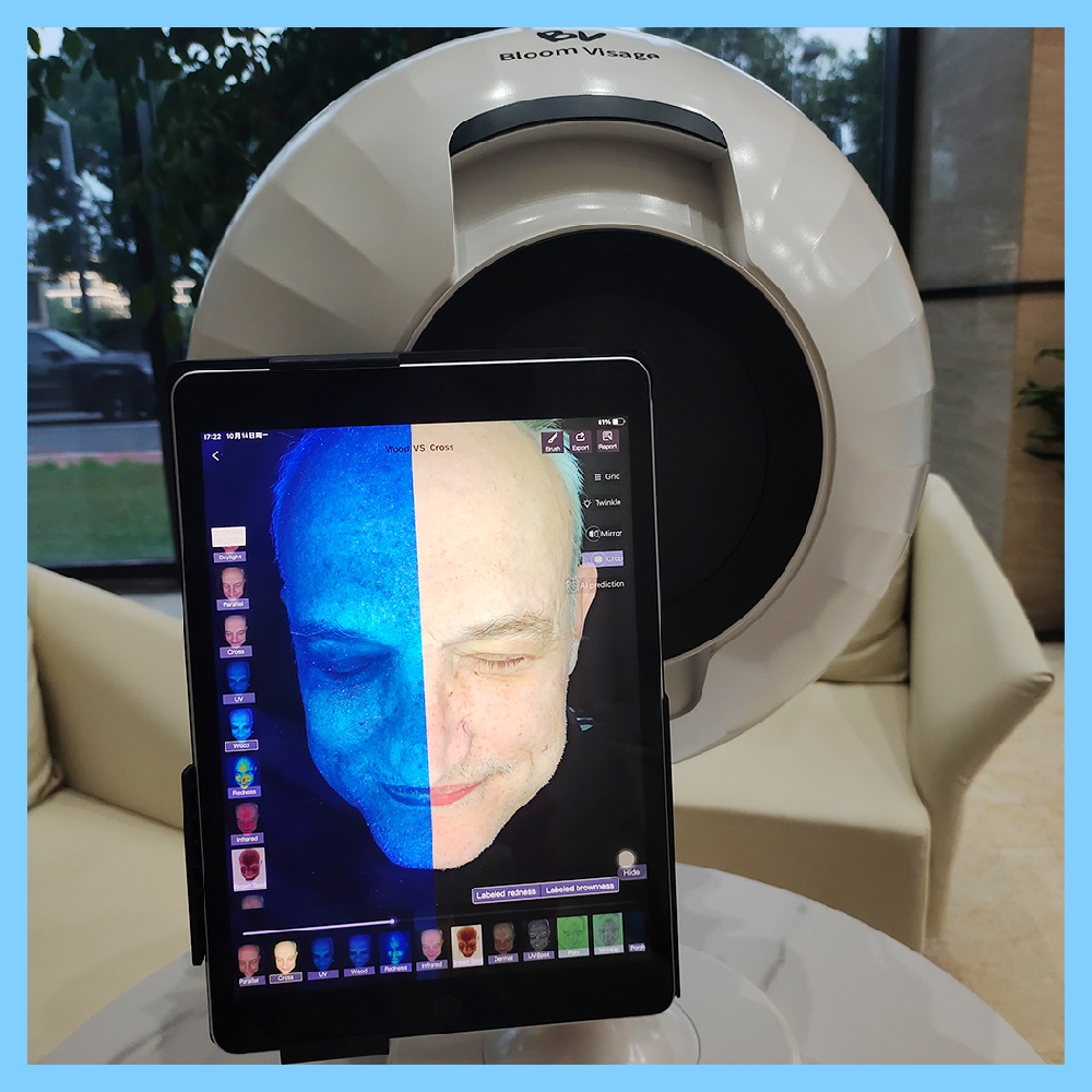 The Implications of Face Scanner Machines for Privacy Rights