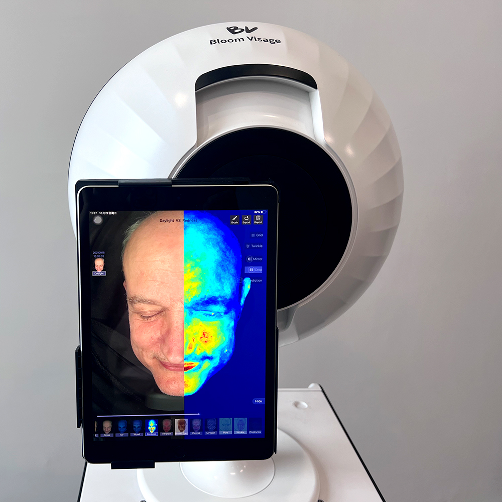 Personalized Skincare Insights at Your Fingertips with the Smart Mirror Skin Analyzer
