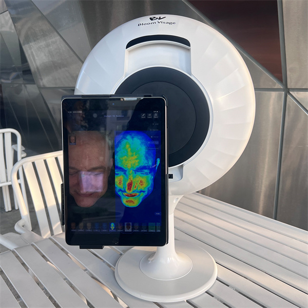 Transform your skincare game with a skin imaging device