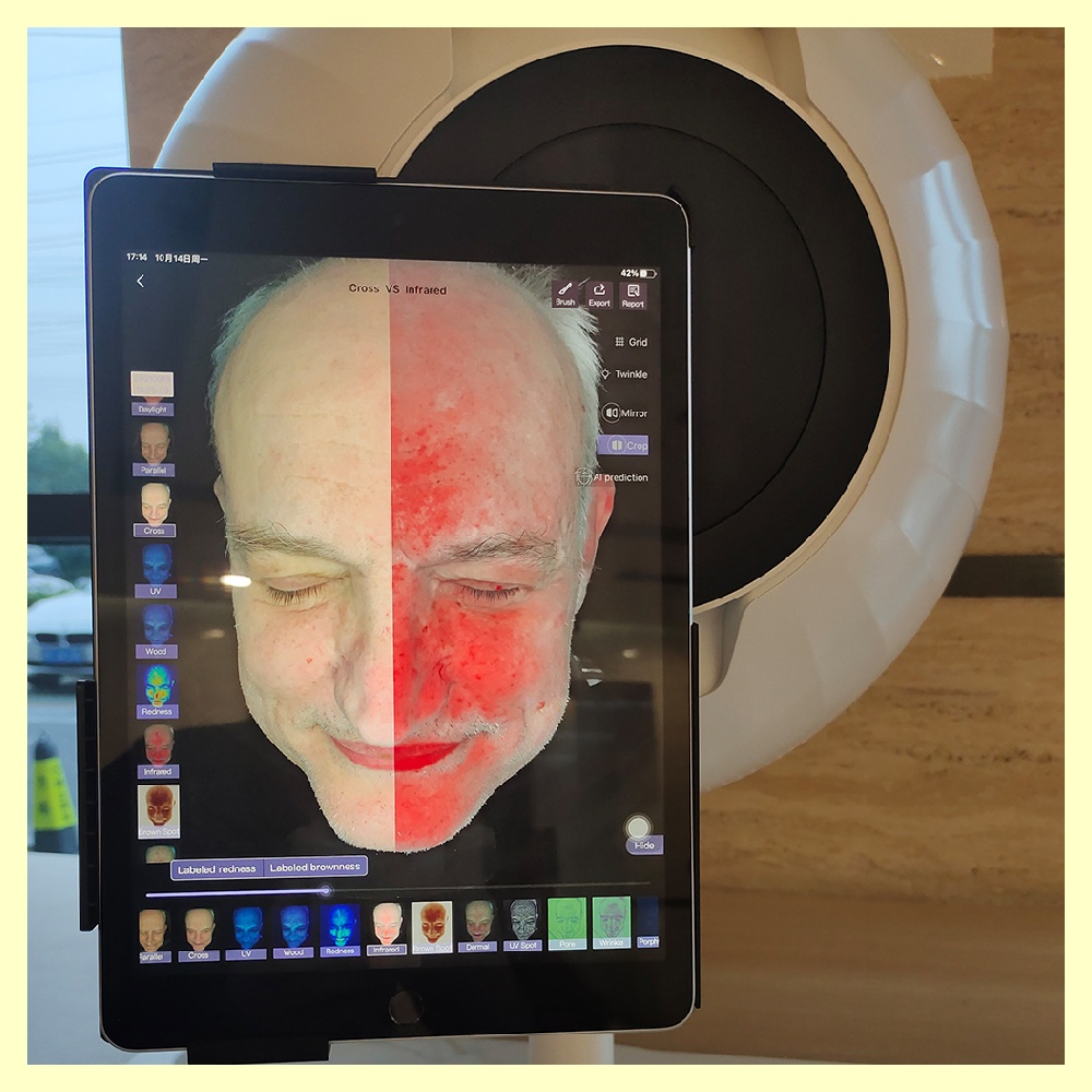 Get Customized Recommendations with a Skin Tone Analyzer Tool