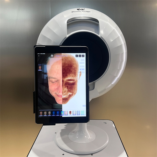 Analyze Your Skin from Anywhere