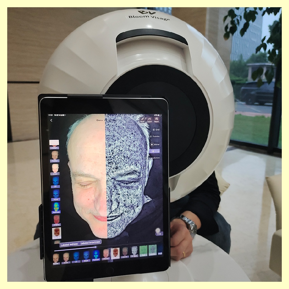 AI-powered skin diagnosis