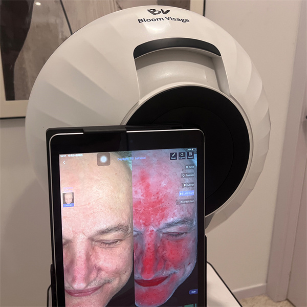 Vypadat nejlépe každý den díky personalizovaným doporučením ohledně krásy založeným na vaší tváři