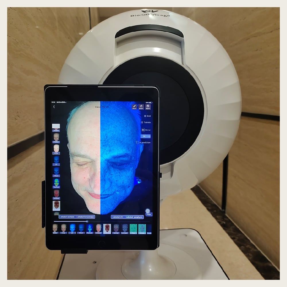 Unlock the Power of Perfect Skin with the Magic Mirror Skin Analyzer