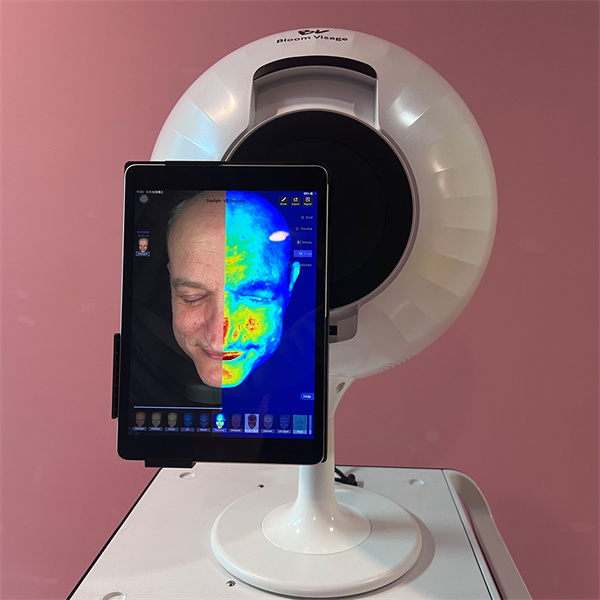 Use the Skin Diagnosis Device for Flawless Skin