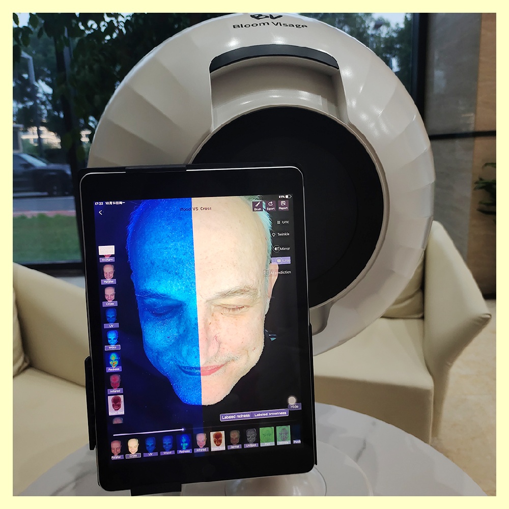 Achieve personalized skincare using the woods lamp skin analyzer