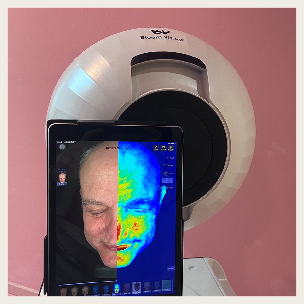 The Benefits of Using a Skin Tone Analyzer