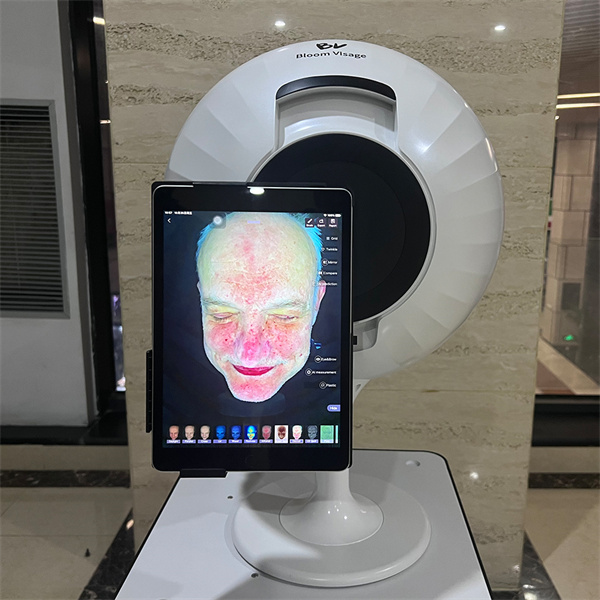 Achieve Your Best Skin Yet with Professional Skin Analysis