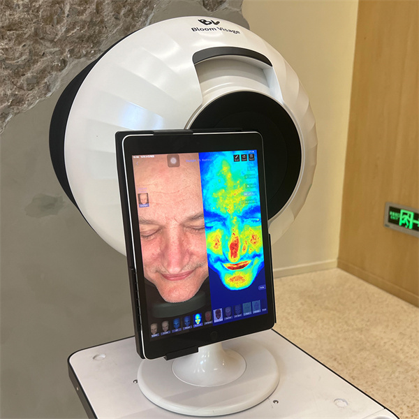 Discover the Top Causes of Your Skin Concerns with This Analyzer