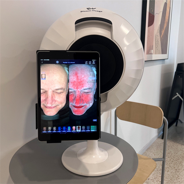 Personalized Skincare Solutions Through Skin Analysis Face Mapping