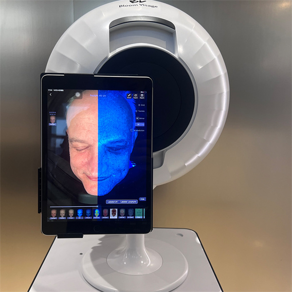Instantly Reveal Skin Concerns with SkinAnalyser
