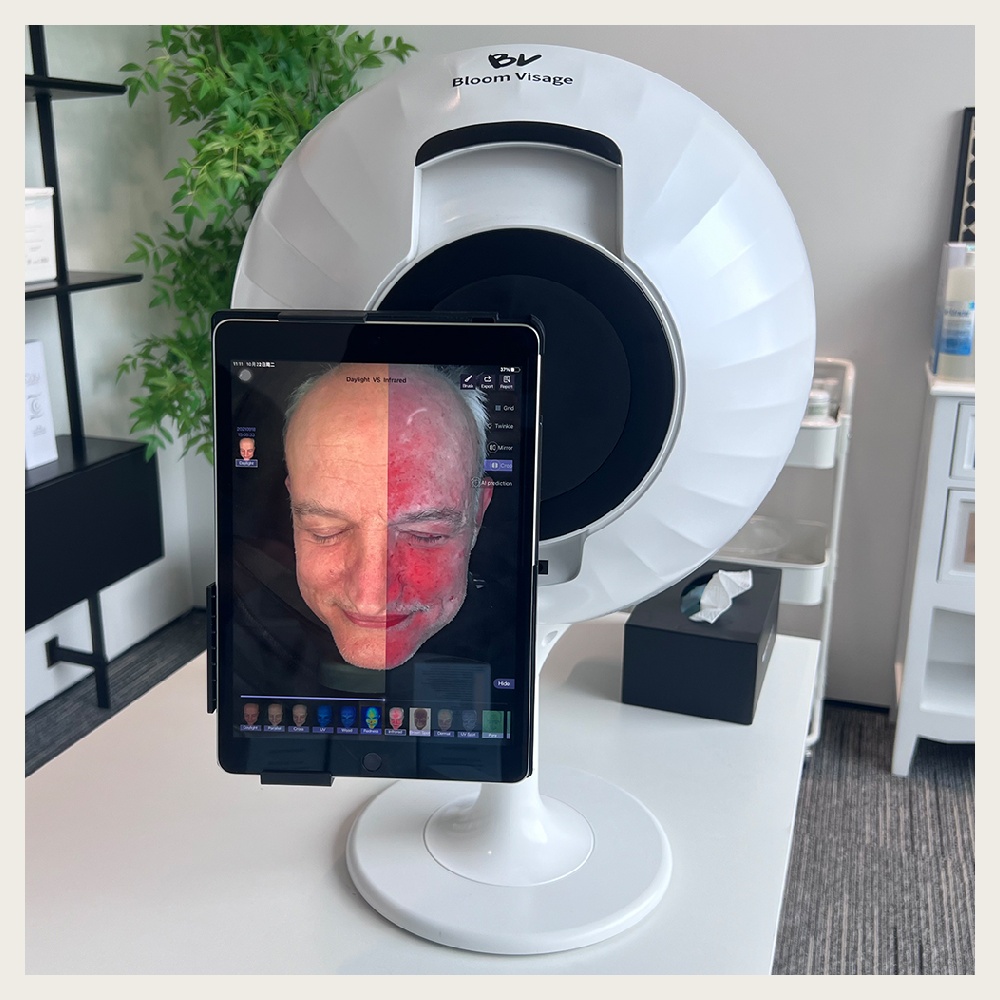 Harnessing the Power of a Skin Analyzer Device