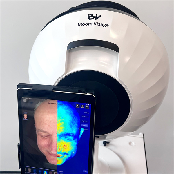 Unveiling the Secret of a Flawless Skin with Digital Analysis