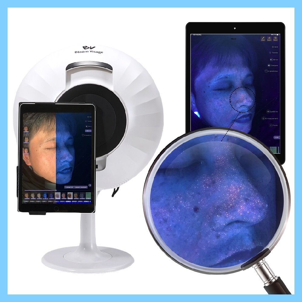 The Role of Woods Lamp Skin Analysis in Skin Cancer Detection