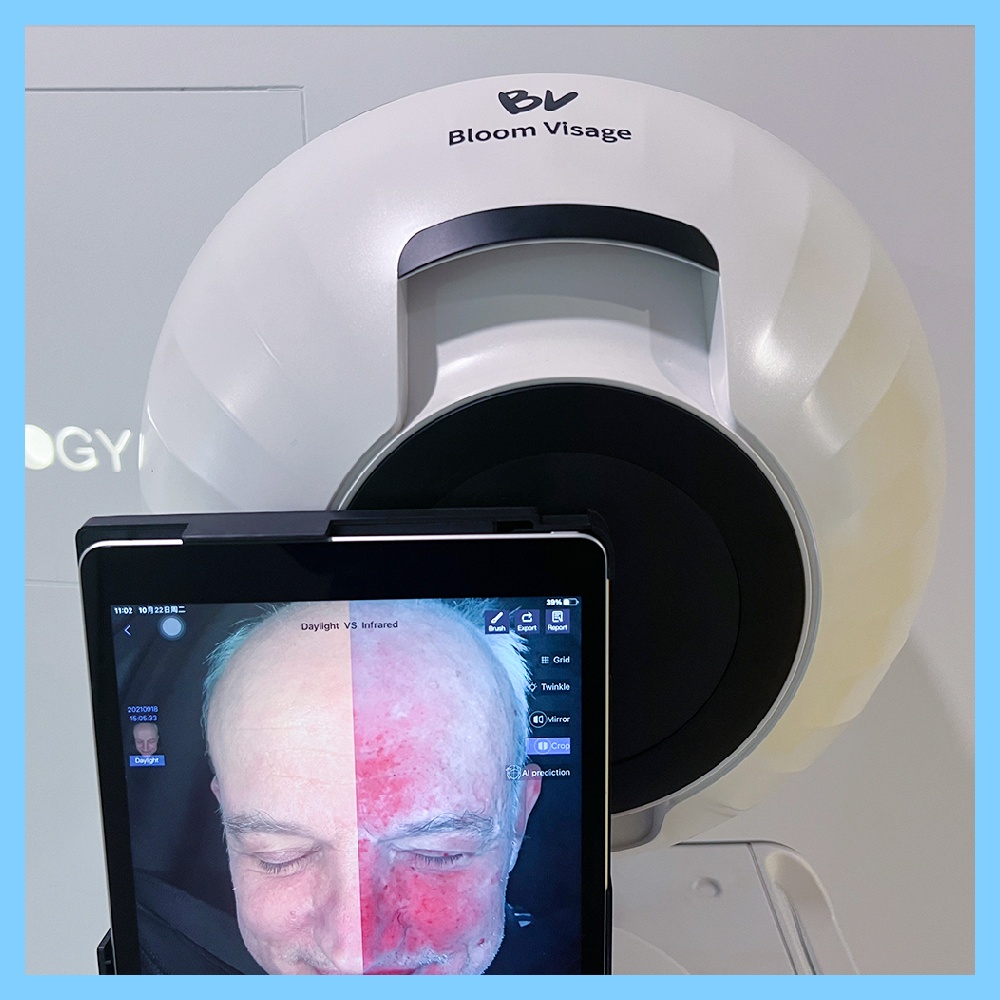 Experience the Magic of Needle-Free Mesotherapy Device