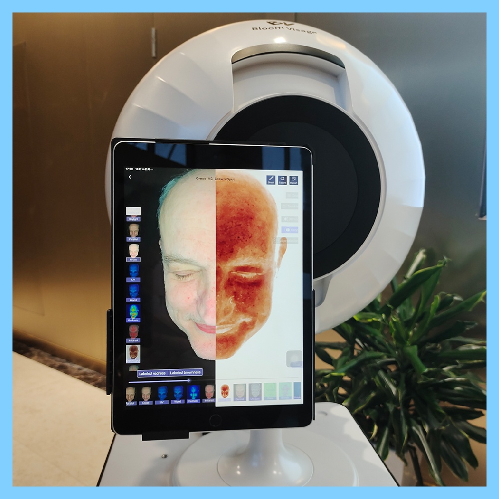 How Meso Machine is Changing the Game