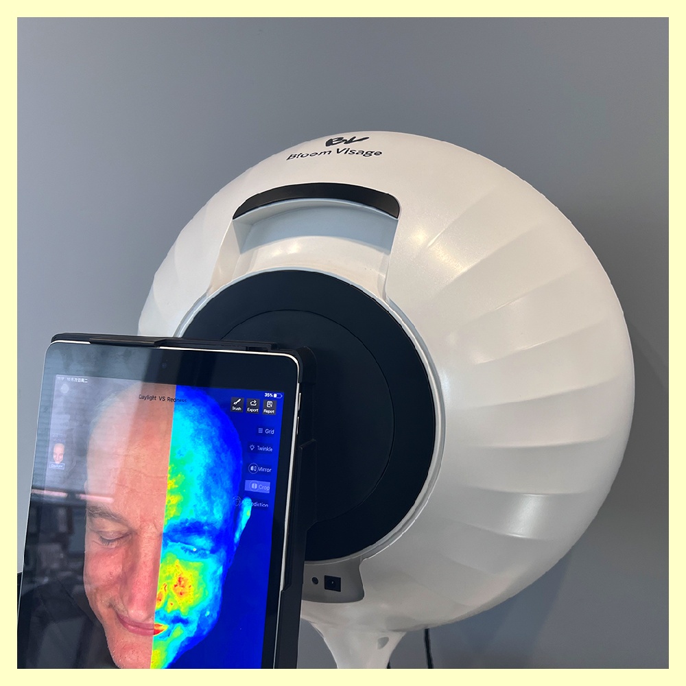Transform Your Skin Care Routine with the Best Skin Analyzer on the Marke