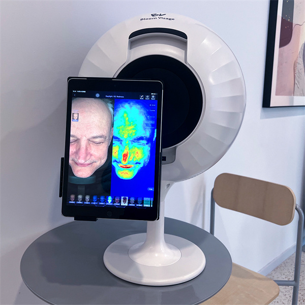 The importance of facial mapping in identifying skin concerns