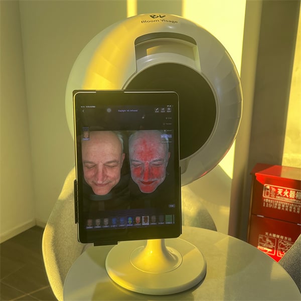 Revolutionizing Healthcare with Facial Recognition and Analysis Technology