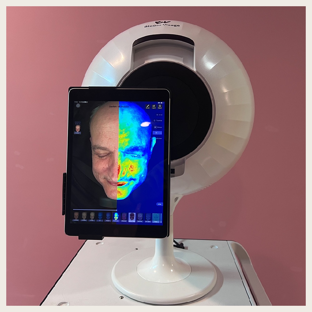 Get to Know Your Skin Test Machine