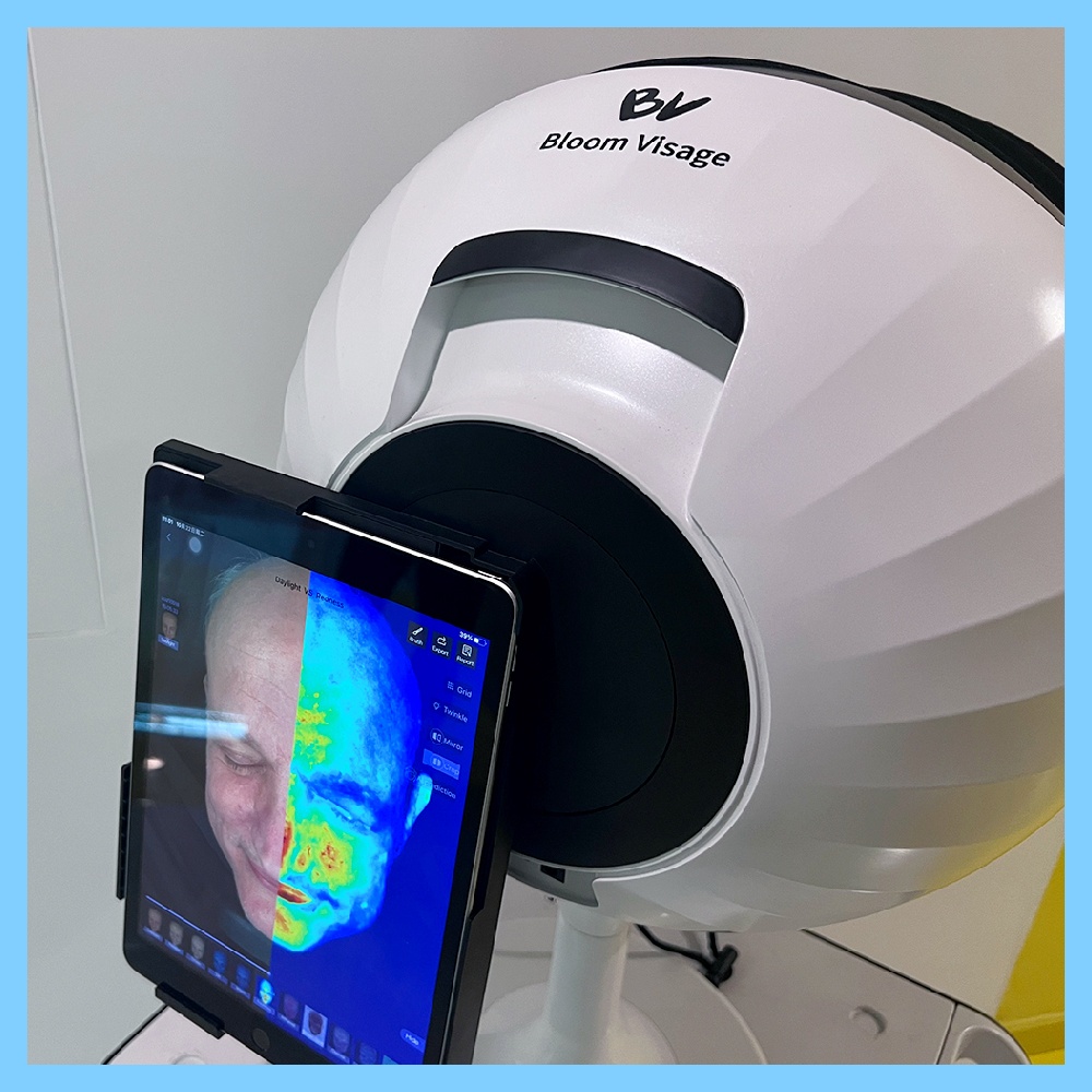 Achieve Flawless Skin with the Facial Skin Analyzer Machine
