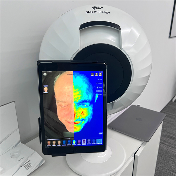 Analyse and improve your skinu2019s moisture barrier