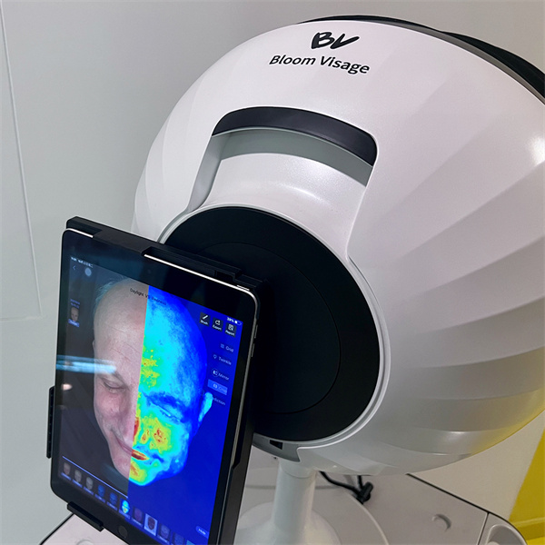 Find Your Perfect Facial Treatment with Skin Analysis