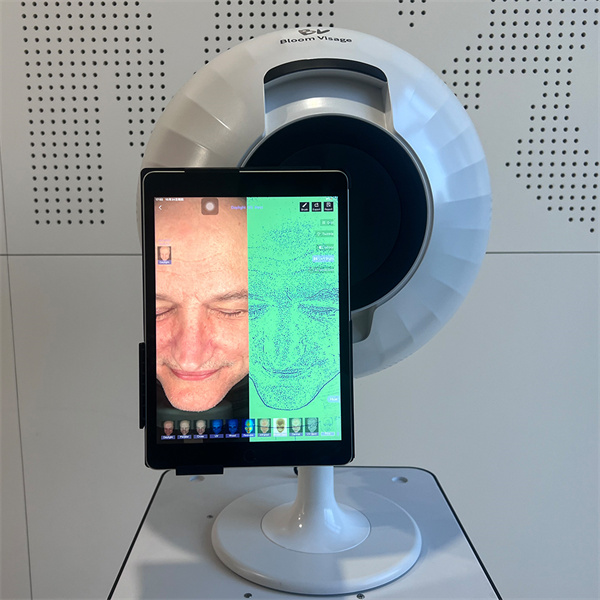 Integrating a Professional Skin Analysis Machine