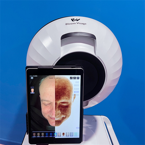 Unveiling the True State of Your Skin with Precision Accuracy