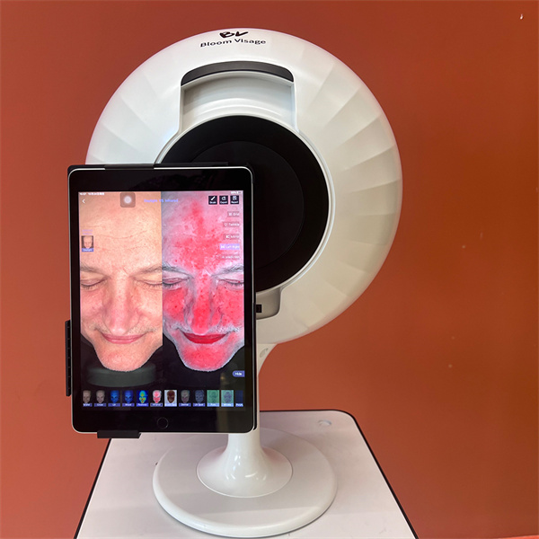 Track your progress and evaluate the effectiveness of your skincare regimen with face skin analyzer