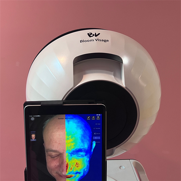 Get a Personalized Skincare Plan with the Skin Diagnosis Device