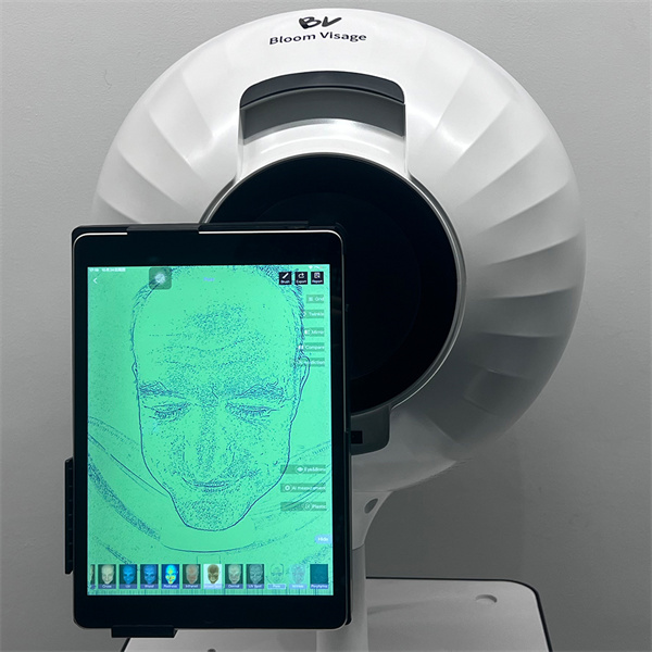 Take Control of Your Skin Health with an Online Skin Analyzer