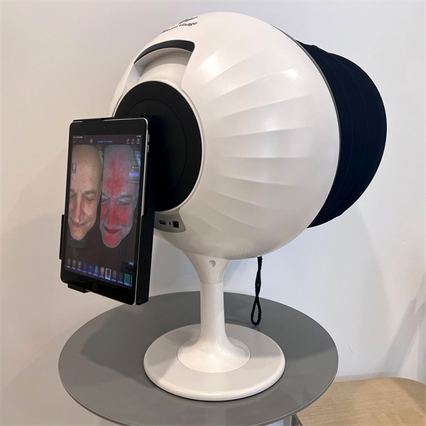 Get the Perfect Skin You Deserve with Skin Analysis Face Mapping