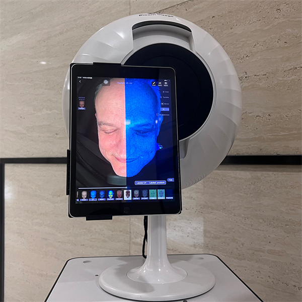 Use Our Free Online Skin Scanner