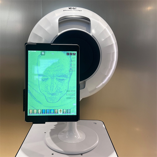 Achieve Perfect Skin with SkinAnalyser