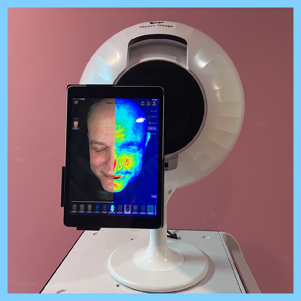 Revitalize Your Skin with a Skin Moisture Meter and Targeted Hydration