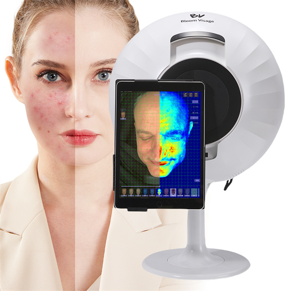 Skin Texture Analysis Face Recognition in Personalized Skincare
