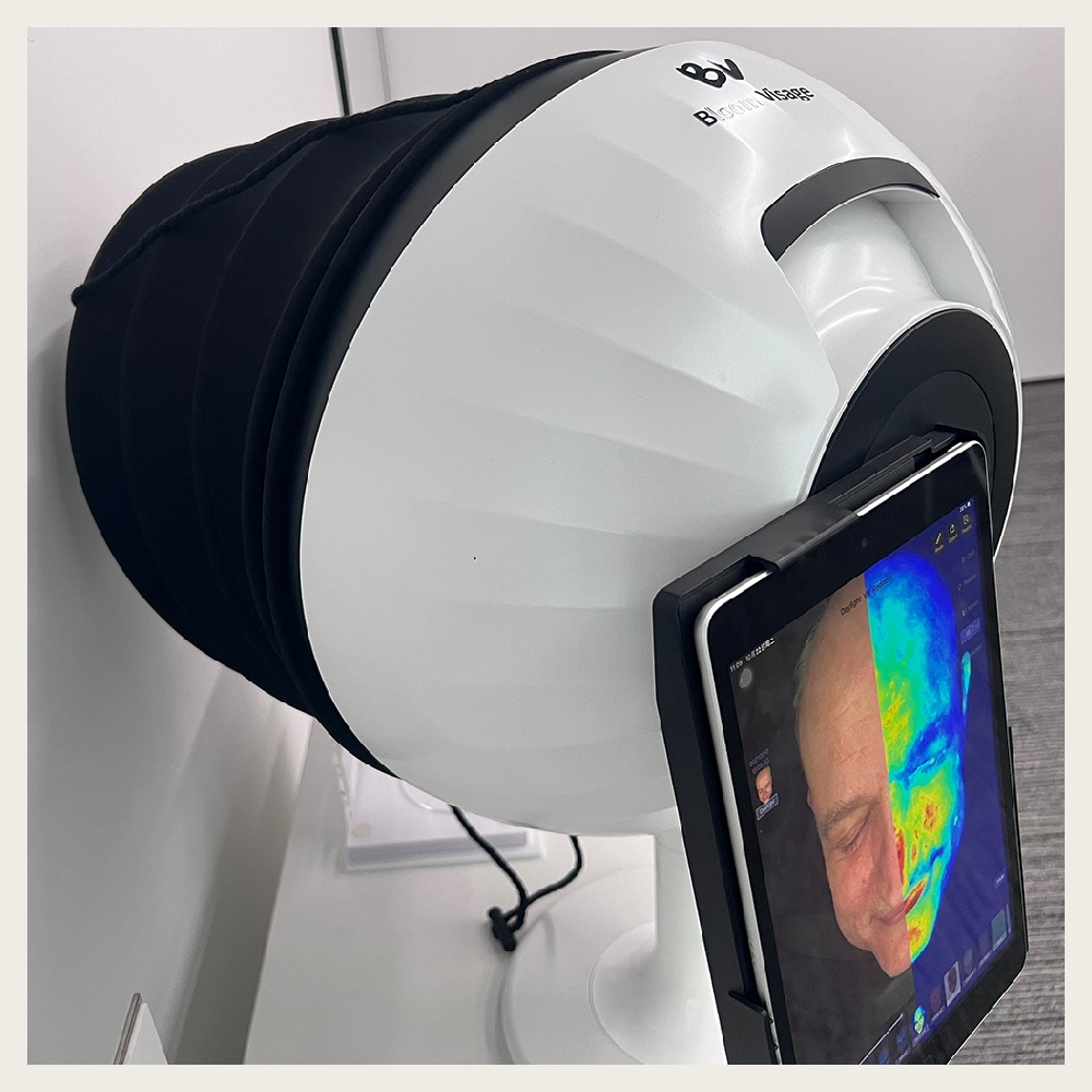 Professional-Grade Skin Analysis at Your Fingertips with the Skin Detector Machine".