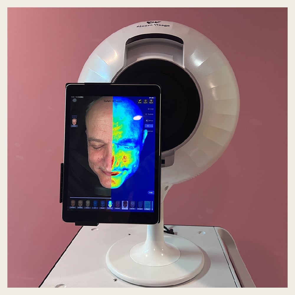 From Fine Lines to Acne, AI Skin Analyzer Reveals All
