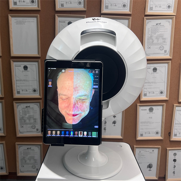 Unlocking the Secrets of your Skin with Digital Analysis