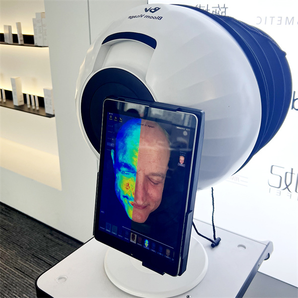 Unlock Your Best Skin with Innovative Smart Mirror Skin Analysis System