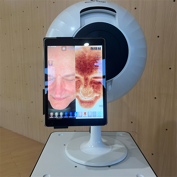 Advanced Skin Analysis Equipment for Personalized Treatment Plans