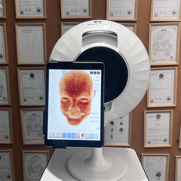 Skin Camera Analysis for Personalized Treatment".