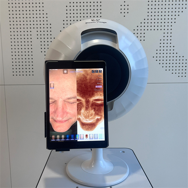 Discover hidden skin problems with cutting-edge skin scanner technology