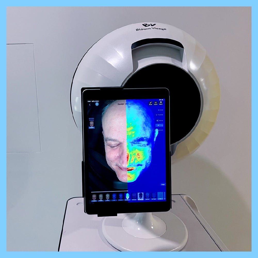 How the Magic Mirror Skin Analyzer Transforms Your Beauty Routine