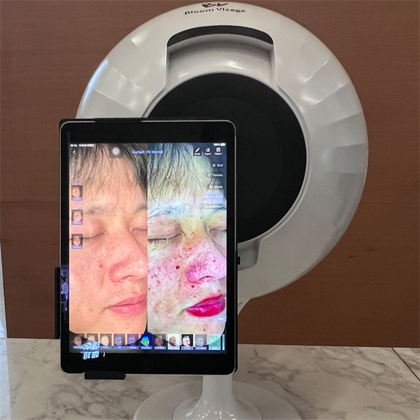 Identifying skin concerns through a thorough analysis