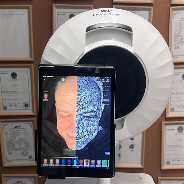 Analyze Your Skin's Condition and Needs from Home