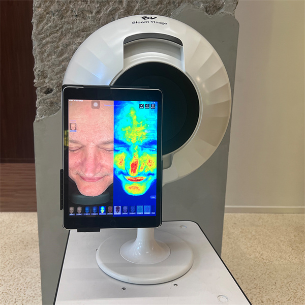 A Skin Condition Analyzer